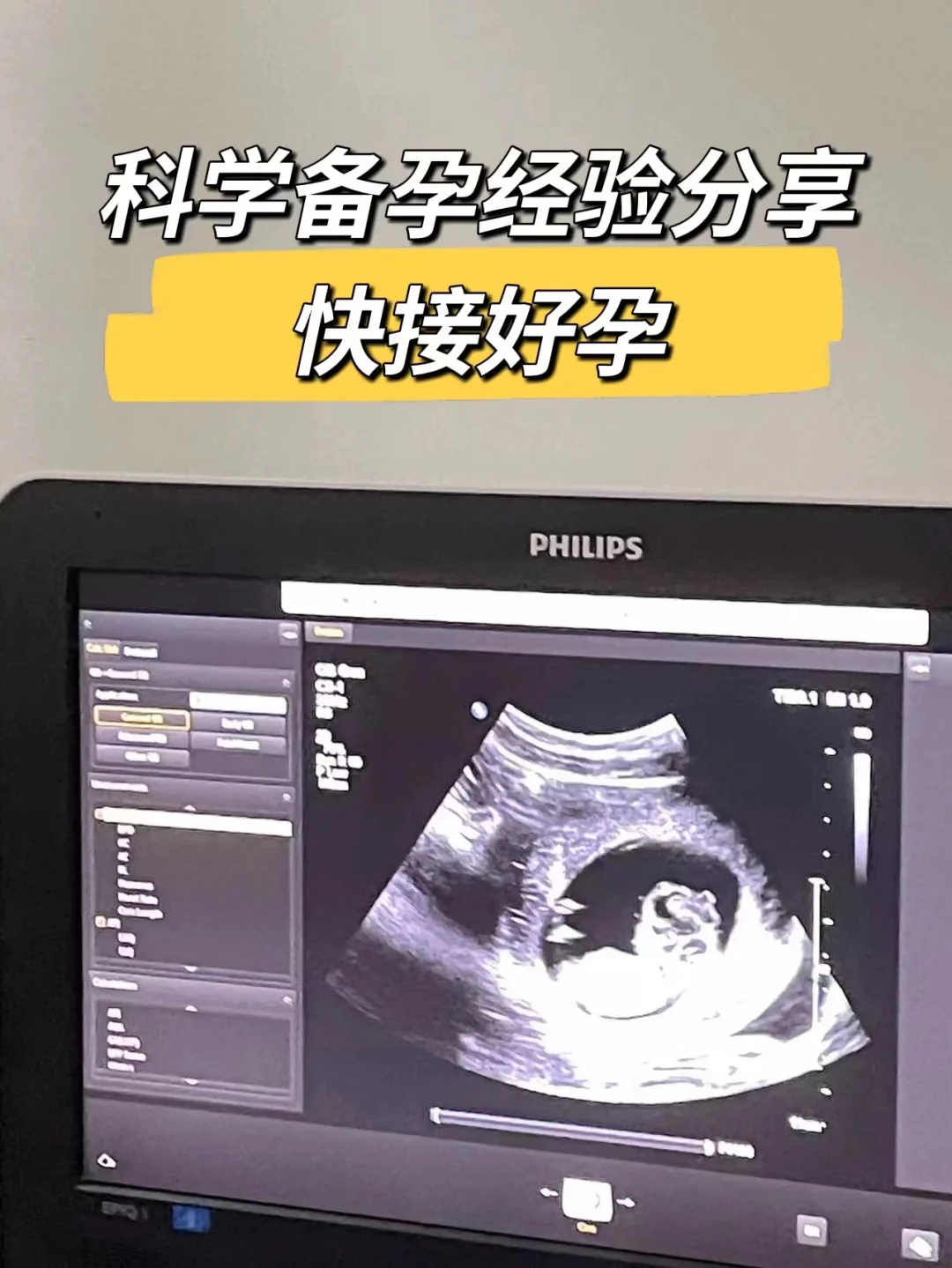 备孕叶酸【爱乐维】