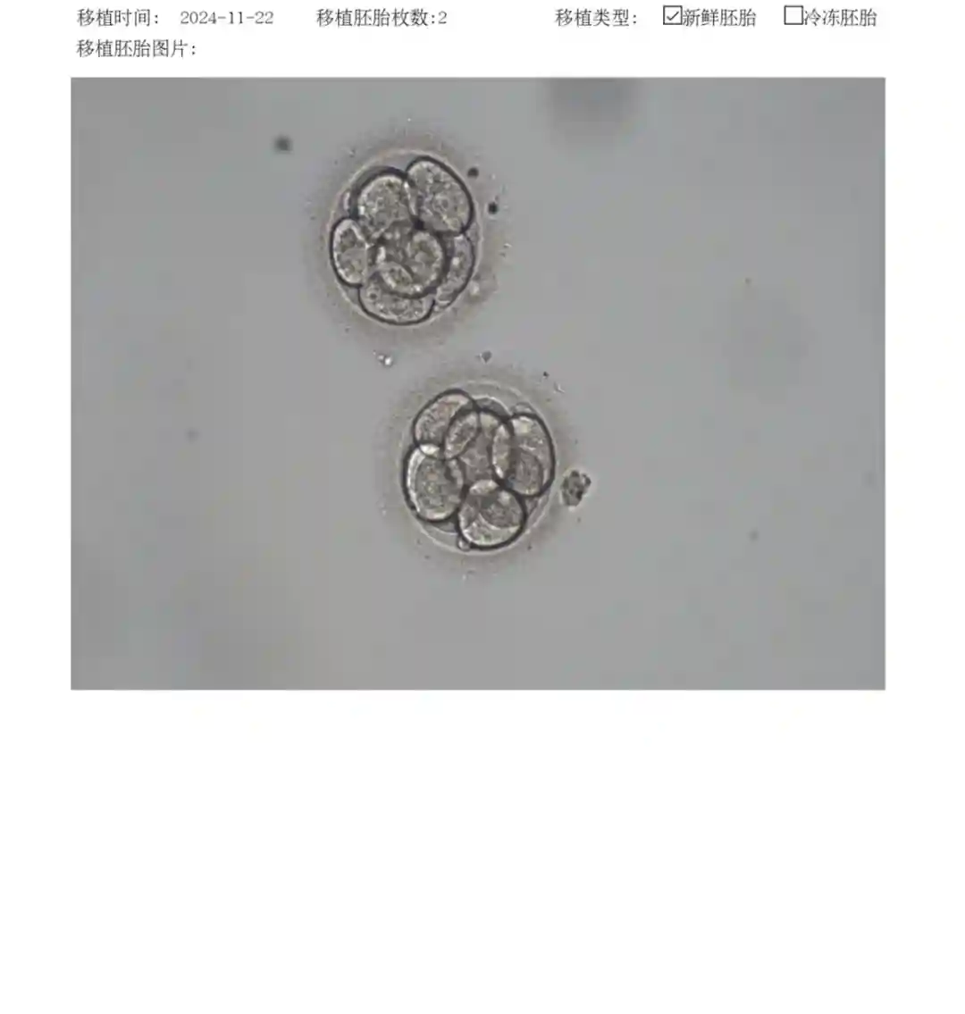 移植2枚8细胞1级鲜胚成功率高吗？