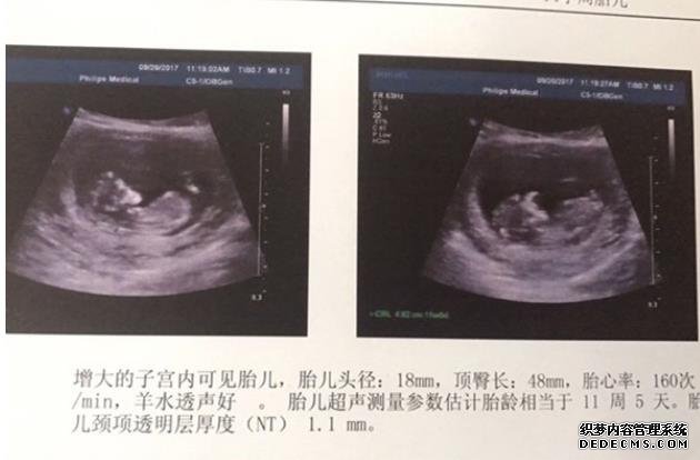 2022年湖北失独家庭60岁补贴标准 湖北妇幼供精试管流程 ‘为什么16zqb超看到了女孩的两条线，最后生了男孩呢？’