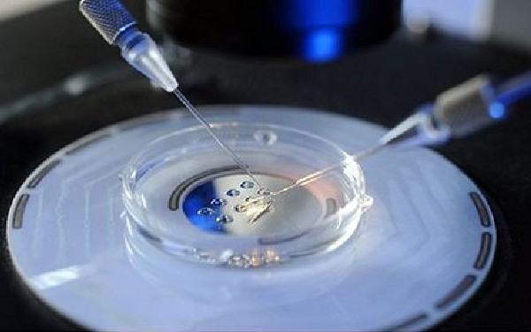 上海哪家医院试管婴儿比较好 2022上海供卵试管多少钱？ ‘ntb超男宝’