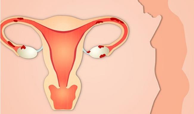 试管婴儿费用可以刷医?？穑咳绾谓档褪怨苡ざ延?？