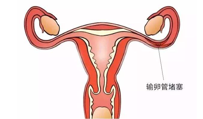 无锡借卵试管过程 2022年无锡三代试管包生孩子的价格是多少？ ‘六周胎儿b超图片看男女’