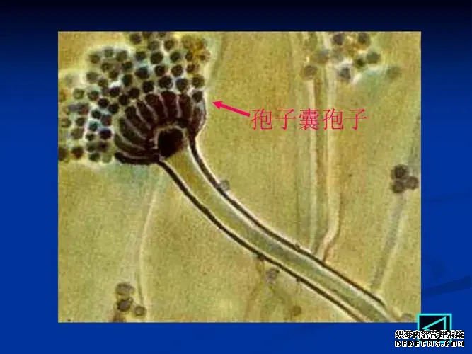 江苏省中医院试管婴儿怎么样 江苏省人民医院供精试管流程介绍： ‘四维胎盘位置判断男女’