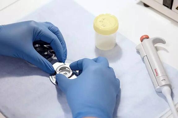 台州试管供卵 最新台州哪家试管医院成功率最高 ‘早唐筛查看男女计算器’