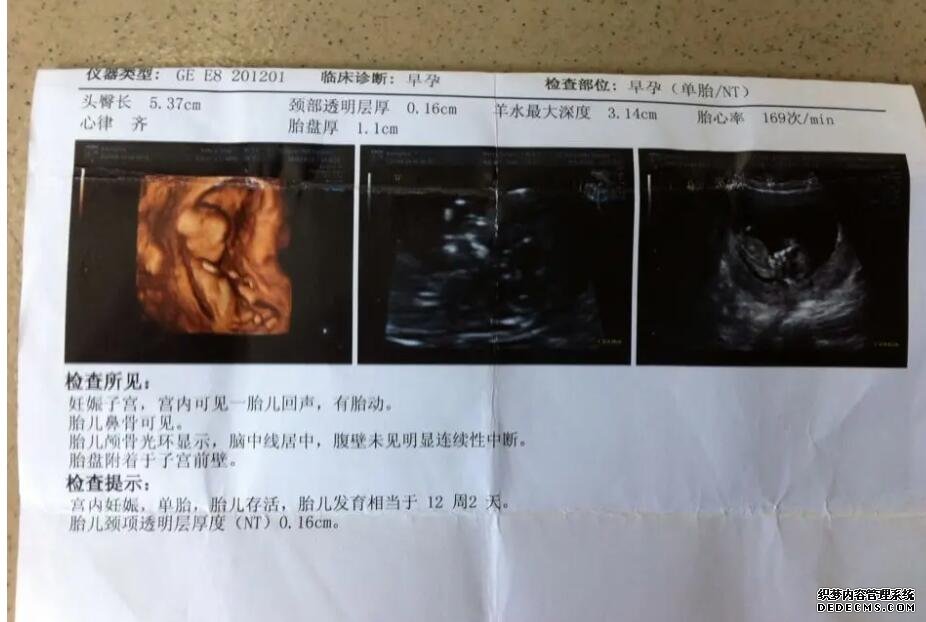 河北洗精 河北十大试管医院排名河北做试管的医院排名 ‘17周查b超查男女准确