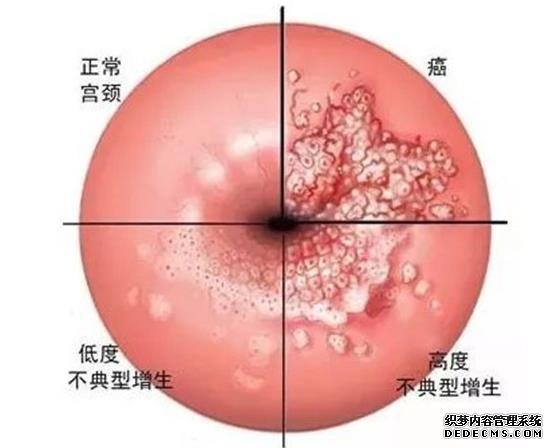 呼和浩特调理生男生女 呼和浩特做供卵试管医院正规排名最新动向 ‘胎囊只有俩个数据个数据看男女公式’