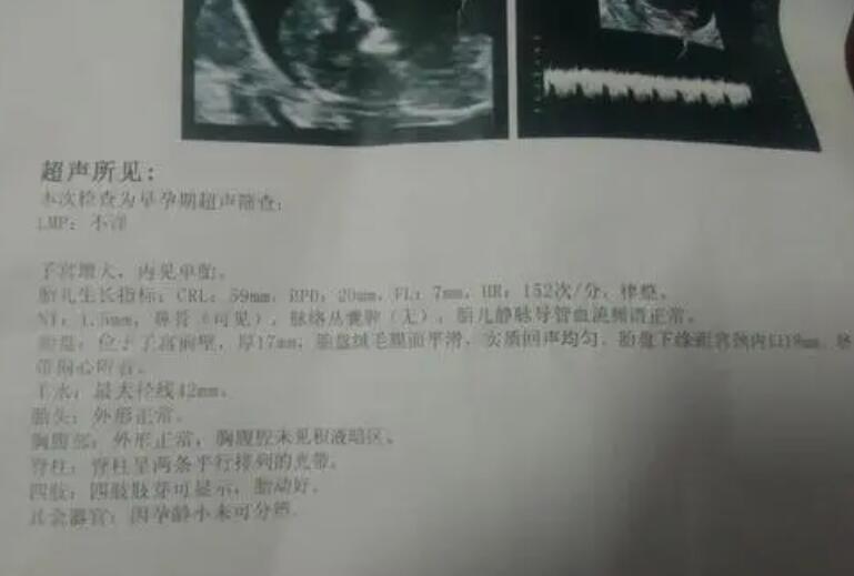 海东供卵试管 上海东方医院生殖医学中心 ‘孕10周b超可以看男女吗’