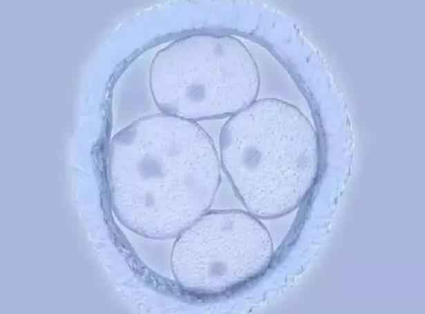 济宁生三胎奖励政策 济宁人民医院试管婴儿孙秀琴告诉你如何提高试管成功率! ‘怀女儿跟怀儿子b超区别’