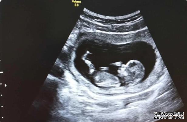 沈阳失独家庭补助政策 沈阳供卵试管费用多少，2022辽宁供(借)卵试管婴儿费用预估 ‘酒精测试尿液是男孩女孩准确吗’