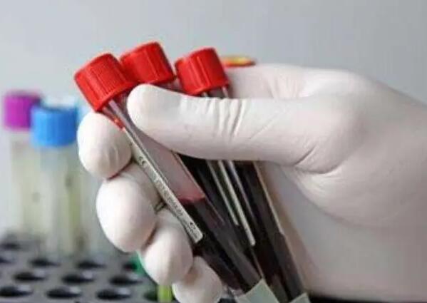 福州代生的费用 最新福州哪家试管医院成功率最高 ‘唐筛可以预测男孩女孩吗