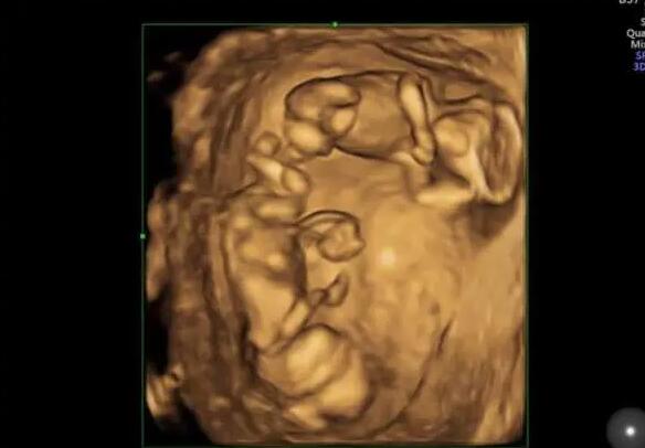 西北妇幼做试管婴儿成功率高不高？一次试管多少钱？