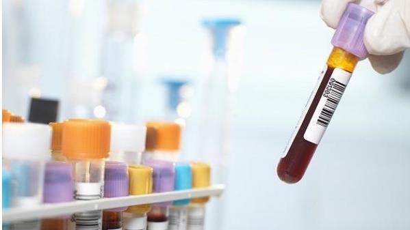 东莞试管怎样 2023
东莞生殖助孕医院试管婴儿费用参考 ‘酒精加尿漂浮在最上