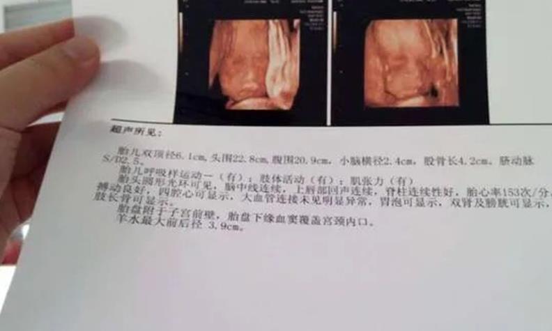 试管婴儿流程是什么？我们一起来看一下详细步骤
