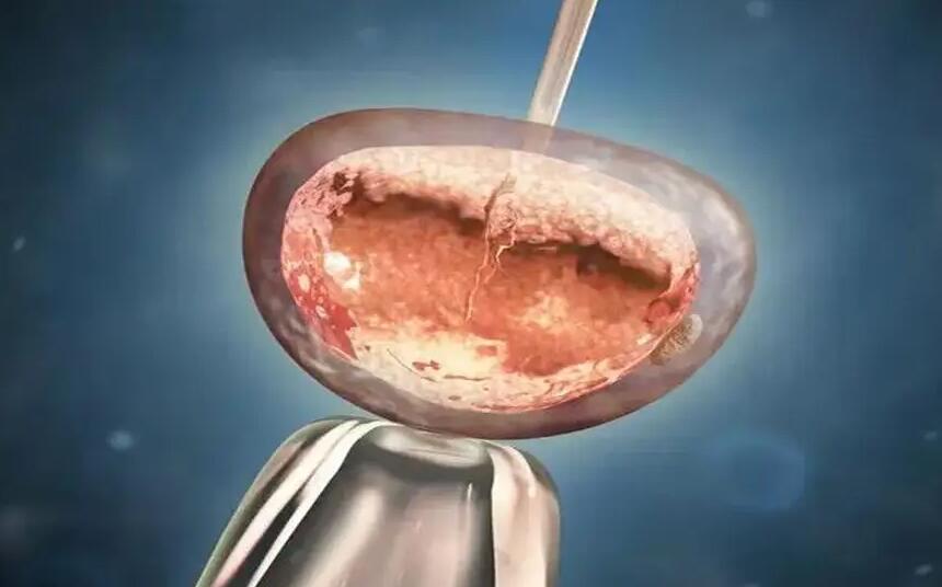 重庆试管医院排名榜重庆试管婴儿 重庆妇幼做试管婴儿的费用多少? ‘24周b超可