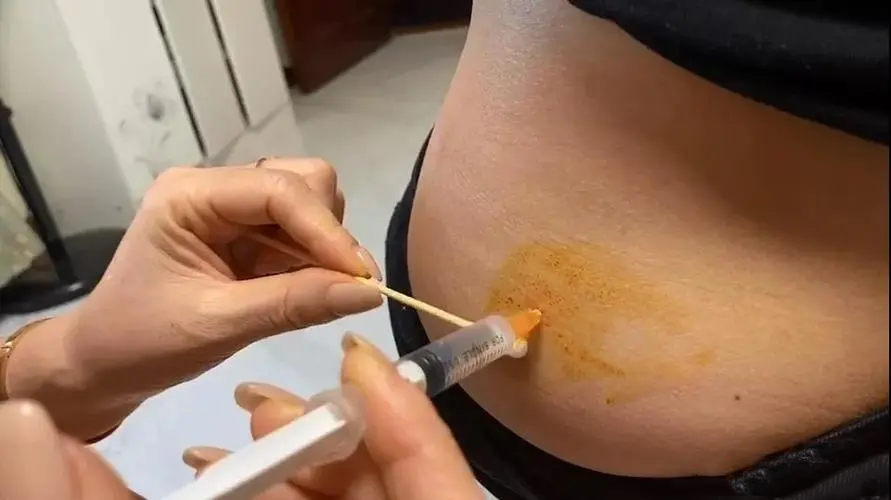 湘潭私立试管 湘潭妇幼生殖中心二代试管婴儿技术怎么样？ ‘营口伊人26周四