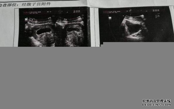 湖南中信湘雅三代试管费用总共多少 湖南省假期工资怎么算? ‘b超看性别男性好看点还是女性’