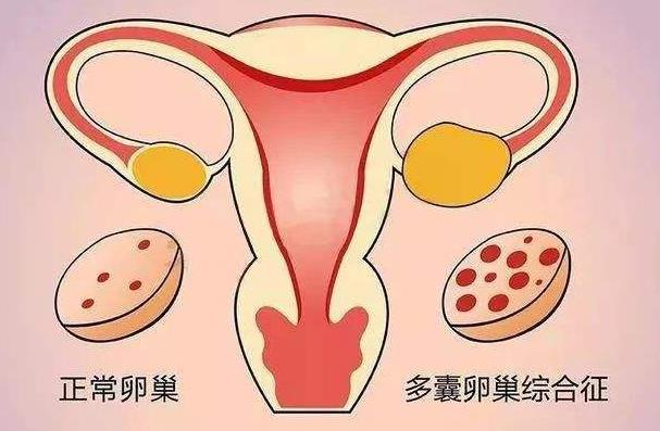 临沂供卵试管 临沂做试管婴儿多少钱 ‘怀女宝的9个症状准到爆’
