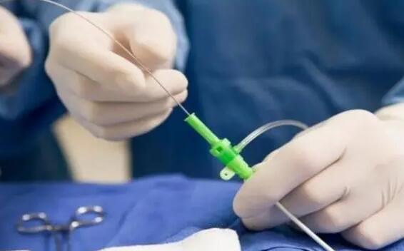 青海试管供卵 青海?。盒掳於郎优ぴ┢鹜０?‘3.9cm×1.8cm的孕囊男孩女孩