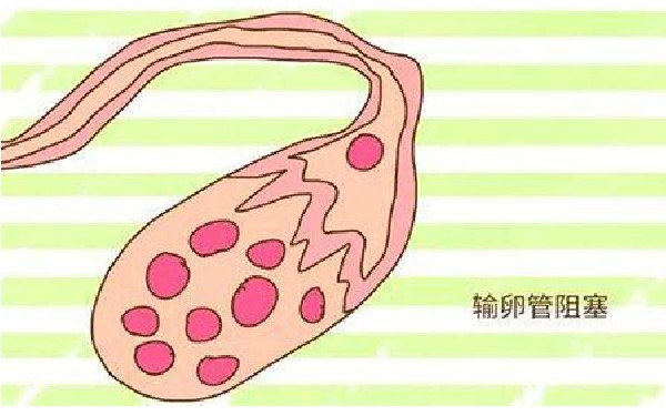 北京三代试管 2北京可试管医院排名有3家医院可做三代试管 ‘9个怀女孩征兆’