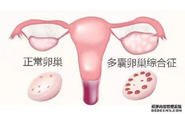 子宫内膜容受性检查——女性生育能力的关键
