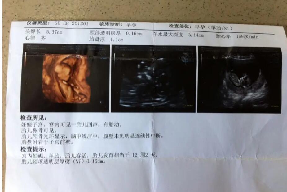 临汾供卵试管 临汾人民医院试管成功率如何? ‘怀女宝的9个症状准到爆’