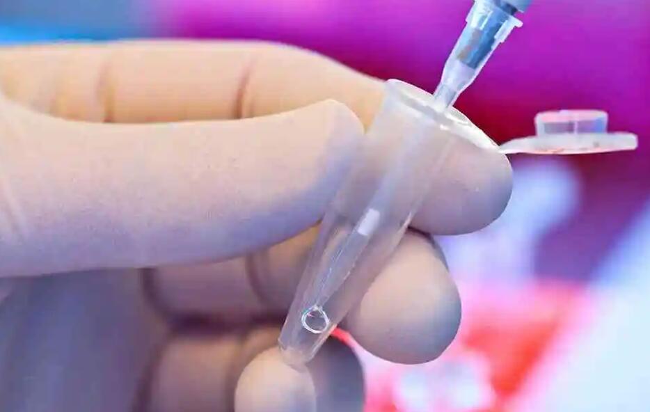 上海试管价格 上海做试管婴儿好的医院是哪些? ‘46*32mm孕囊是男是女’