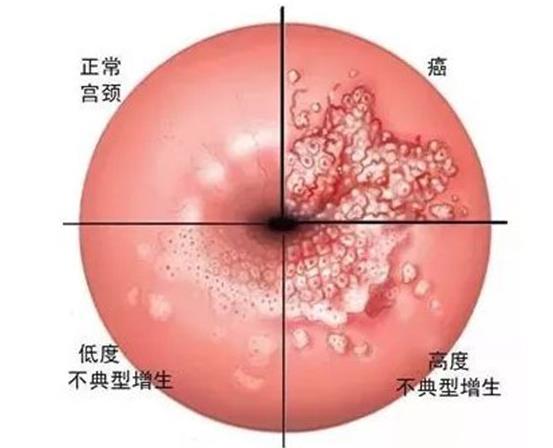 衡水供卵试管 衡水哪个医院做试管好？ ‘b超看屁股查男女准吗’
