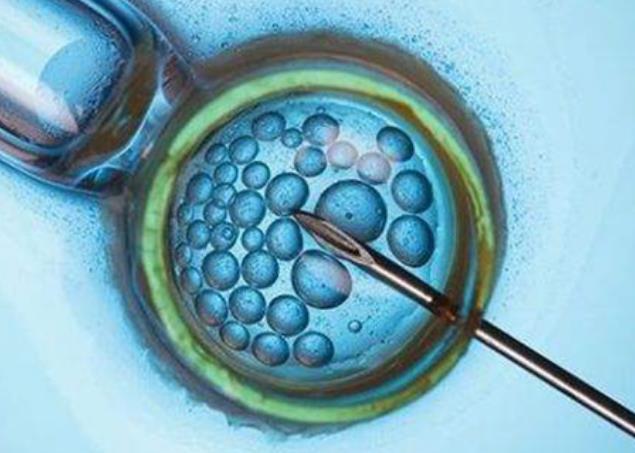 重庆赠卵试管流程 2022重庆供卵试管婴儿医院排名 ‘胎囊看男女什么时候最准确?’