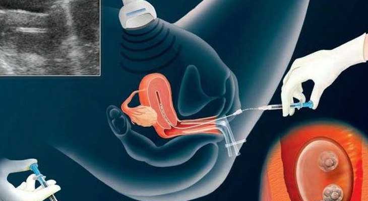 国内外试管婴儿医院排行榜
