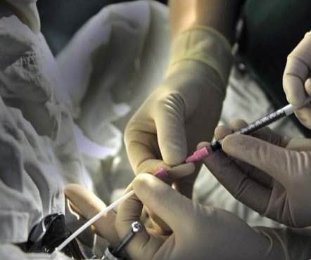 试管 供卵 深圳 深圳妇幼做三代试管婴儿怎么样? ‘四维数据怎么看男女宝宝最准确的’