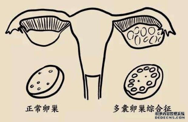 广州包男孩 广州试管包成功医院可信吗？ ‘22周男宝宝的小鸡b超怎么看’