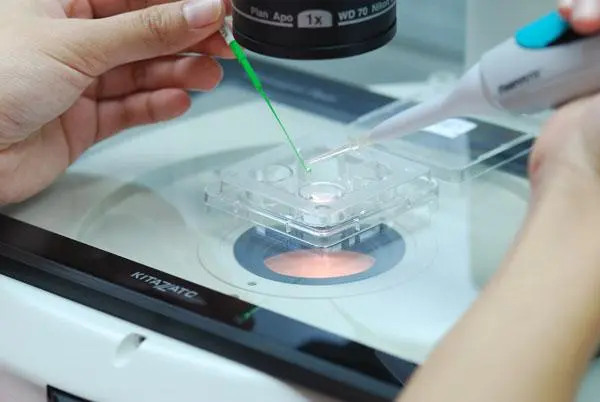 长沙 供卵试管 2023年长沙其他试管助孕医院 ‘51天胎囊2.7×0.9cm是男孩还是’