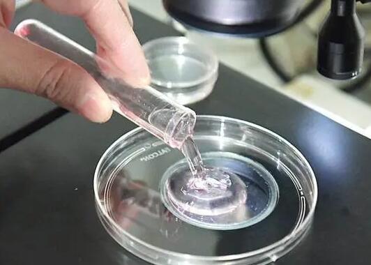 洛阳试管医院 洛阳妇幼保健院做试管怎么样？这家医院如何？ ‘b超看屁股查男女准吗’