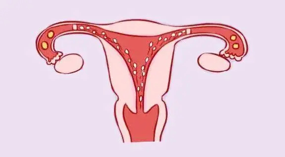 试管婴儿胚胎选哪种好？移植哪种胚胎比较好？