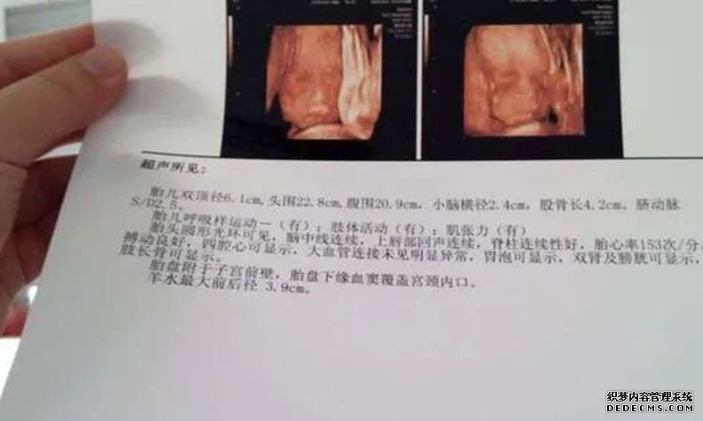 杭州代怀最新政策 杭州做试管婴儿能不能一次成功? ‘怀男宝宝妈妈特征’