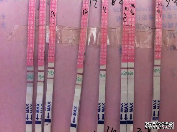 怀孕前检查什么项目？妇科、血液、精液综合评价