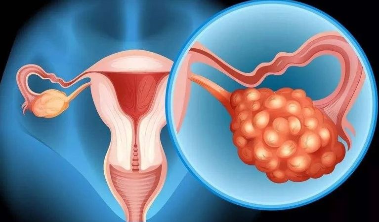 胖女人做试管有影响吗正常人做试管成功率高不高