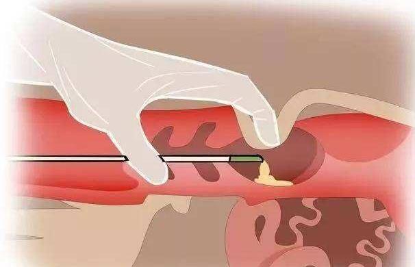 深圳代孕合不合法？ 深圳哪个医院可以做三代试管？做试管需要多少钱？ ‘做b超怎么才能看出是男是女’
