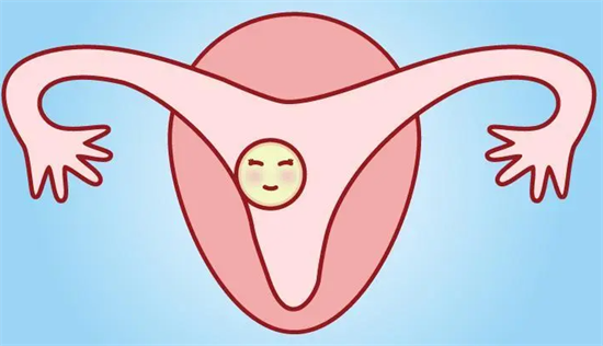 74.png