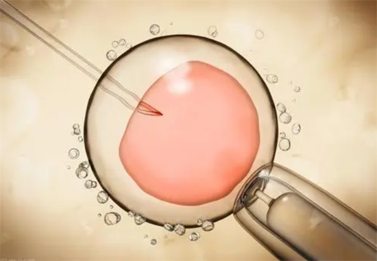 62.png