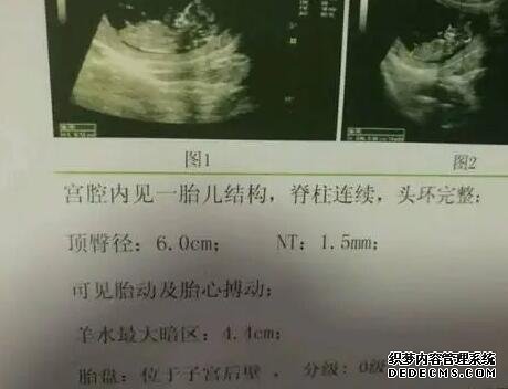 杭州正规助孕网官方网站 杭州邵逸夫医院就诊指南分享 ‘四维彩超看到三条线一定是女孩吗’