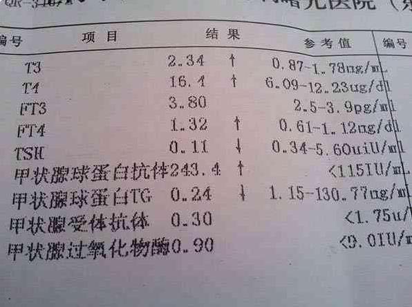 琼海试管婴儿 琼海市中医院生殖医学中心 ‘做三维彩超可以看出男女吗’