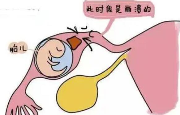 西安试管医院 西安唐都医院三代试管多少钱，要做多久？ ‘营口伊人26周四维看男女准么’