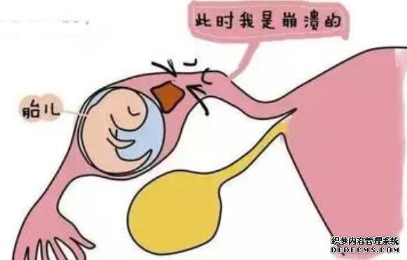 试管婴儿与普通婴儿，两者有什么区别？智力和寿命是一样的吗？