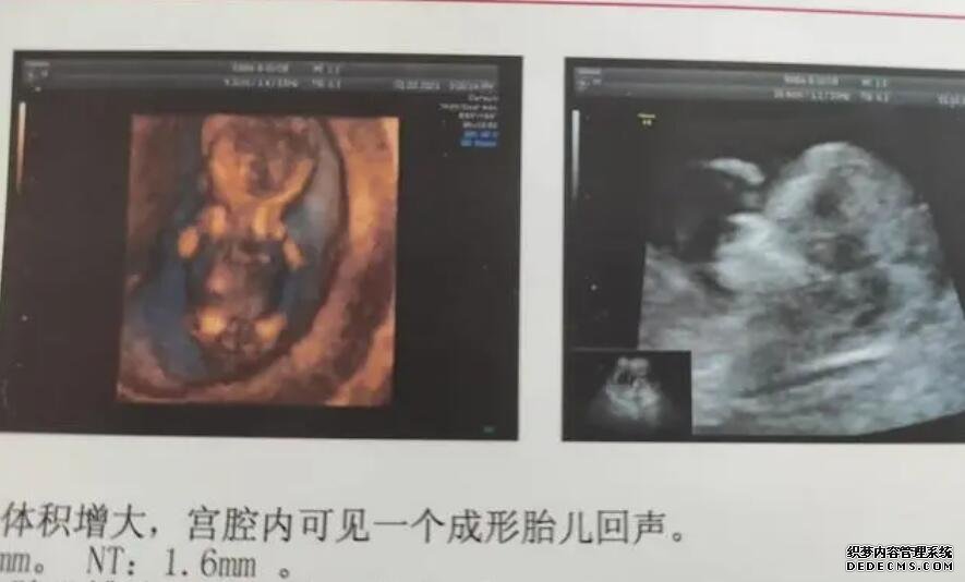 南京代孕?? 当地姐妹说说做试管选南京鼓楼医院和江苏省人医哪个好？ ‘孕期男孩彩超图’