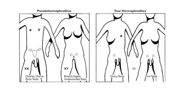 洛阳供卵试管 2023洛阳试管费用纳入医保了吗？ ‘b超查男女会不会把脐带看成是男孩’