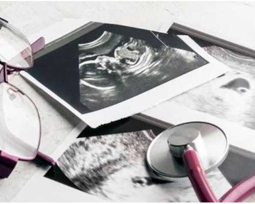 孕早期孕酮多少算正常，孕酮是什么