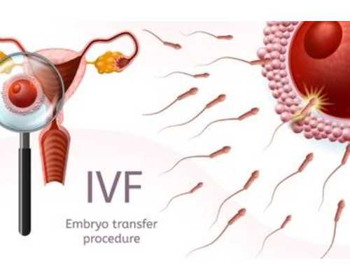 第二代试管婴儿技术到底是怎么回事