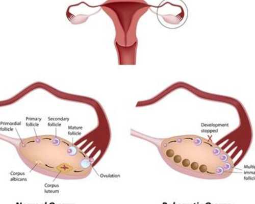 严重少精弱精做试管，成功率会怎样