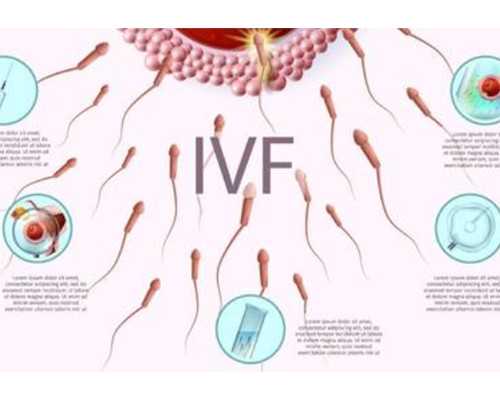 东莞试管婴儿医生怎么选